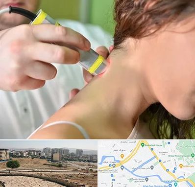 لیزر درمانی در کوی وحدت شیراز