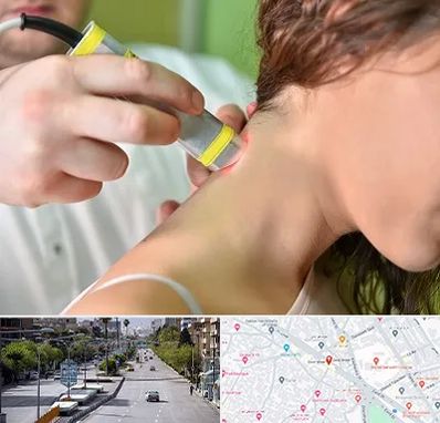 لیزر درمانی در خیابان زند شیراز