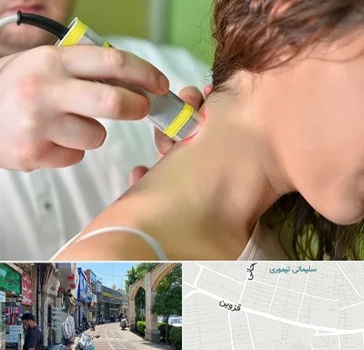 لیزر درمانی در خیابان قزوین