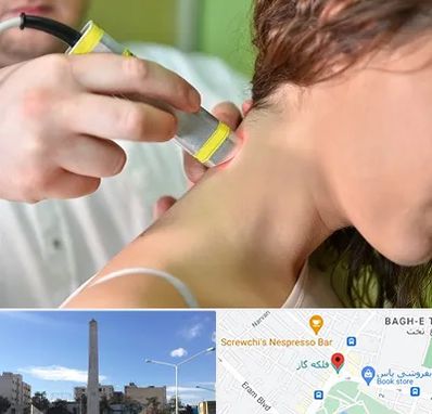 لیزر درمانی در فلکه گاز شیراز