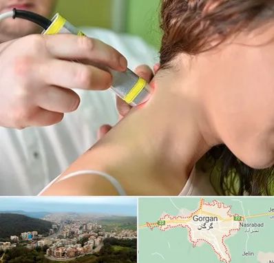 لیزر درمانی در گرگان