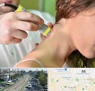 لیزر درمانی در جنوب تهران