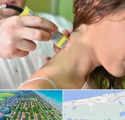 لیزر درمانی در فریدونکنار