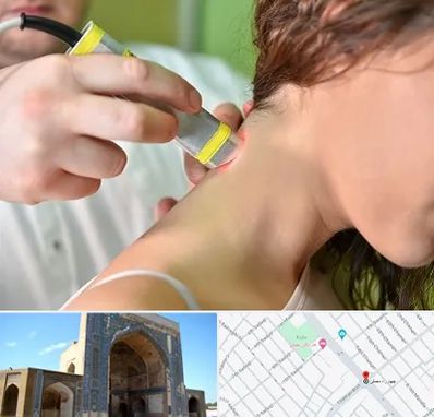 لیزر درمانی در مصلی مشهد