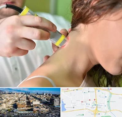 لیزر درمانی در شهرک راه آهن