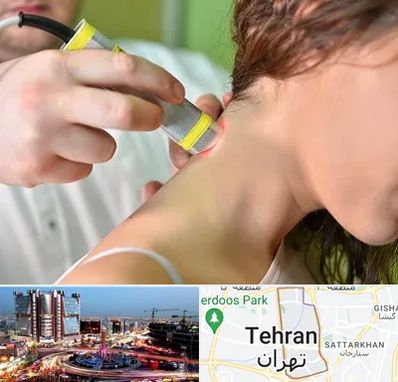 لیزر درمانی در صادقیه