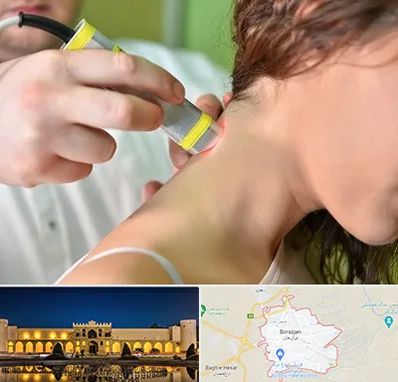 لیزر درمانی در برازجان