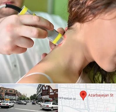 لیزر درمانی در خیابان آذربایجان