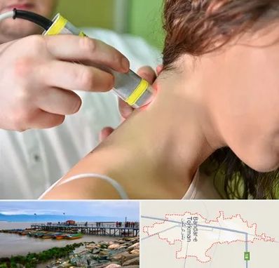 لیزر درمانی در بندر ترکمن