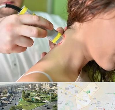 لیزر درمانی در کمال شهر کرج