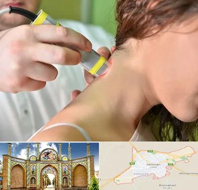 لیزر درمانی در سمنان