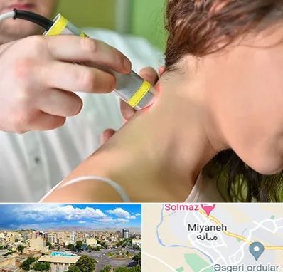 لیزر درمانی در میانه