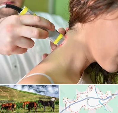 لیزر درمانی در تالش