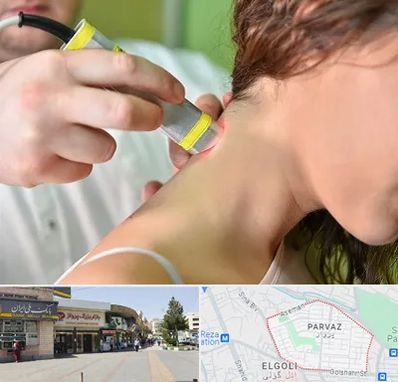 لیزر درمانی در پرواز تبریز