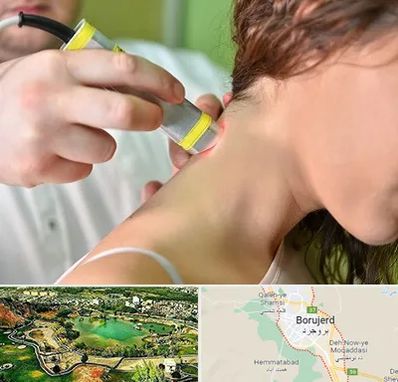 لیزر درمانی در بروجرد