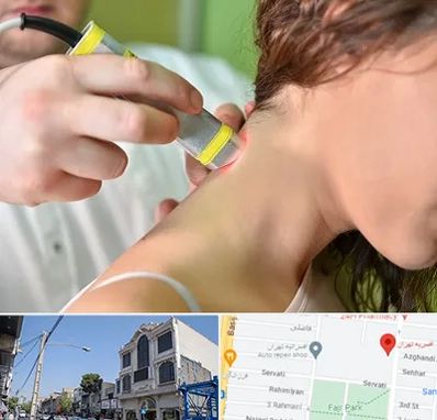 لیزر درمانی در افسریه