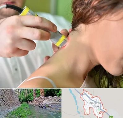 لیزر درمانی در سراوان