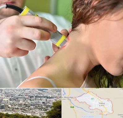 لیزر درمانی در یاسوج