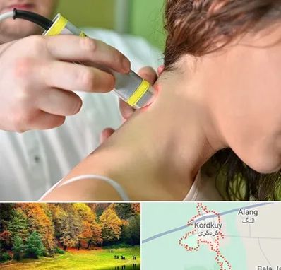 لیزر درمانی در کردکوی