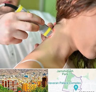 لیزر درمانی در نیاوران