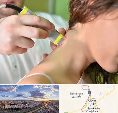 لیزر درمانی در قم