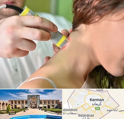 لیزر درمانی در کرمان