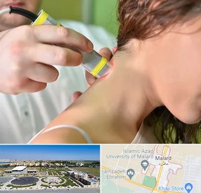 لیزر درمانی در ملارد