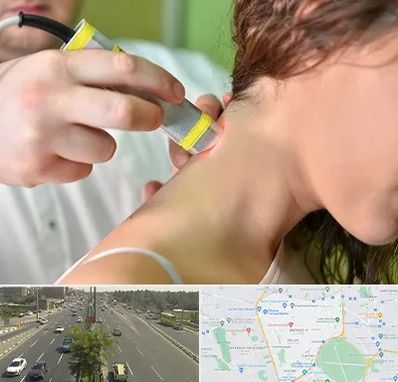 لیزر درمانی در منطقه 17 تهران