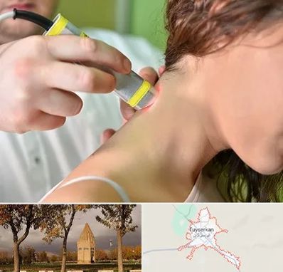 لیزر درمانی در تویسرکان