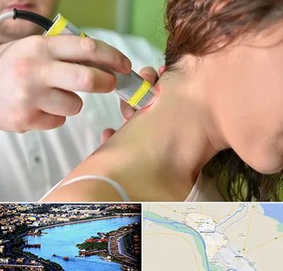 لیزر درمانی در خرمشهر