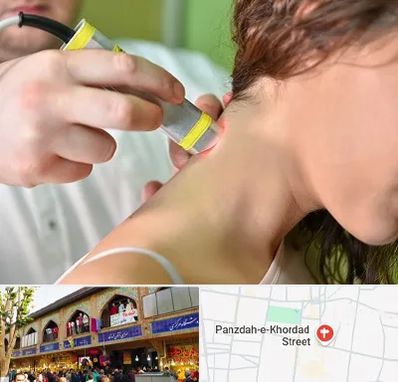 لیزر درمانی در 15 خرداد