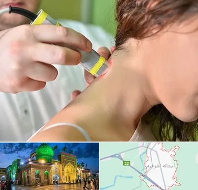 لیزر درمانی در آستانه اشرفیه