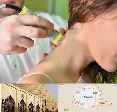 لیزر درمانی در ساوه