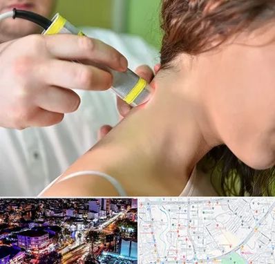 لیزر درمانی در منظریه رشت