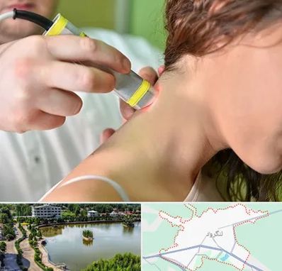 لیزر درمانی در لنگرود