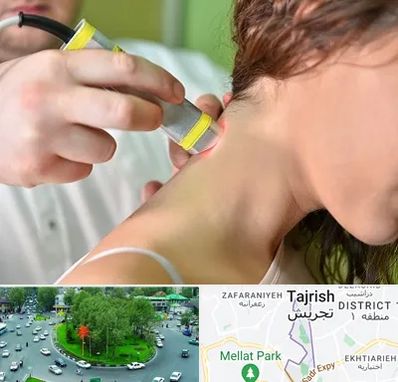 لیزر درمانی در تجریش