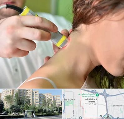 لیزر درمانی در آپادانا