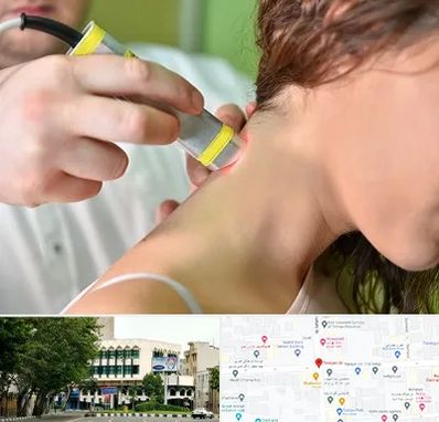 لیزر درمانی در طالقانی