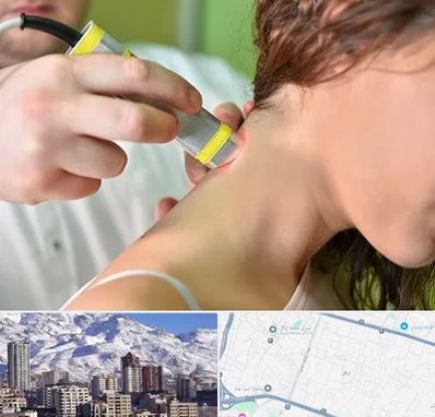 لیزر درمانی در ازگل