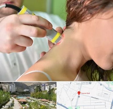 لیزر درمانی در بلوار تعاون