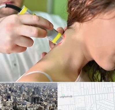 لیزر درمانی در جیحون