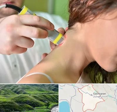 لیزر درمانی در گچساران