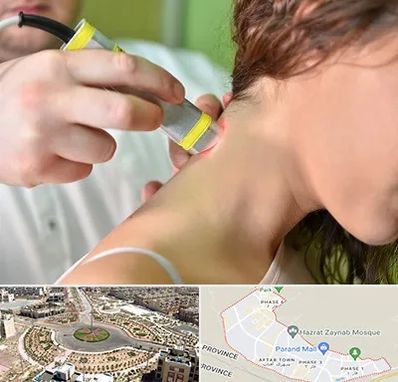 لیزر درمانی در پرند