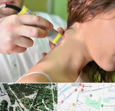 لیزر درمانی در سالاریه قم