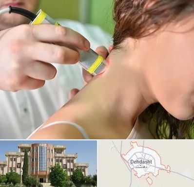 لیزر درمانی در دهدشت