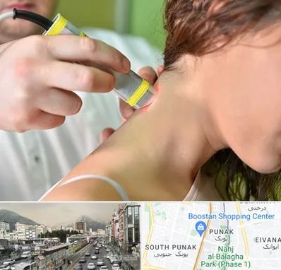 لیزر درمانی در پونک