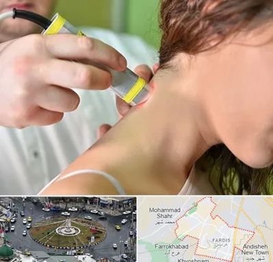 لیزر درمانی در فردیس کرج