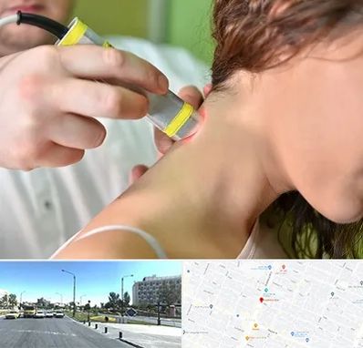 لیزر درمانی در بلوار کلاهدوز مشهد