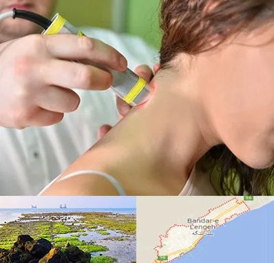 لیزر درمانی در بندرلنگه