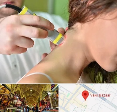 لیزر درمانی در بازار وکیل شیراز